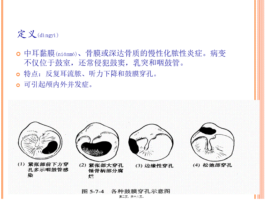 2022年医学专题—慢性化脓性中耳炎剖析(1).ppt_第2页