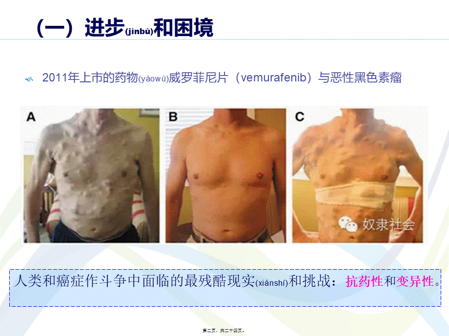 2022年医学专题—关于癌症的深度科普.ppt_第2页