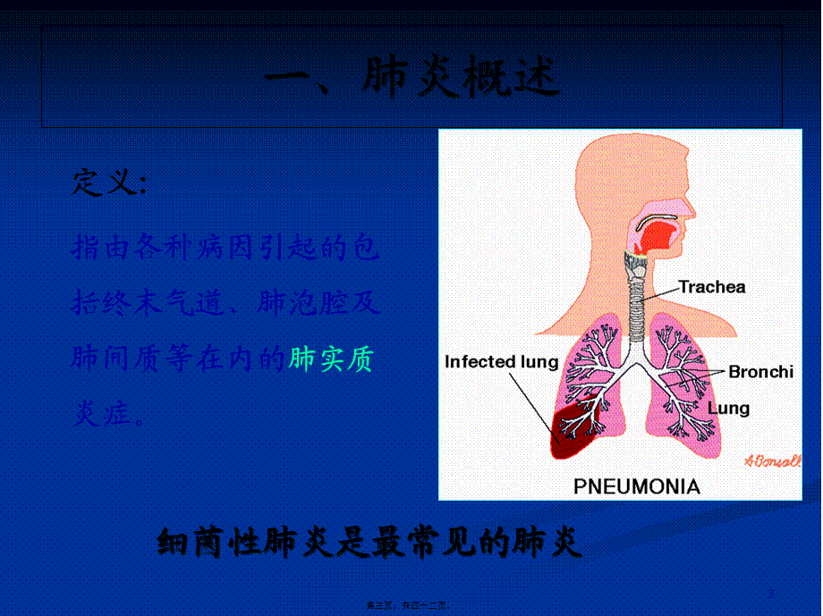 五、肺炎球菌肺炎.pptx_第3页