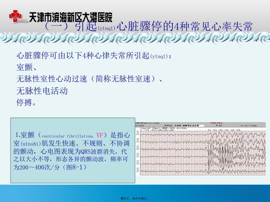 2022年医学专题—四、心脏骤停与心肺复苏.pptx_第3页