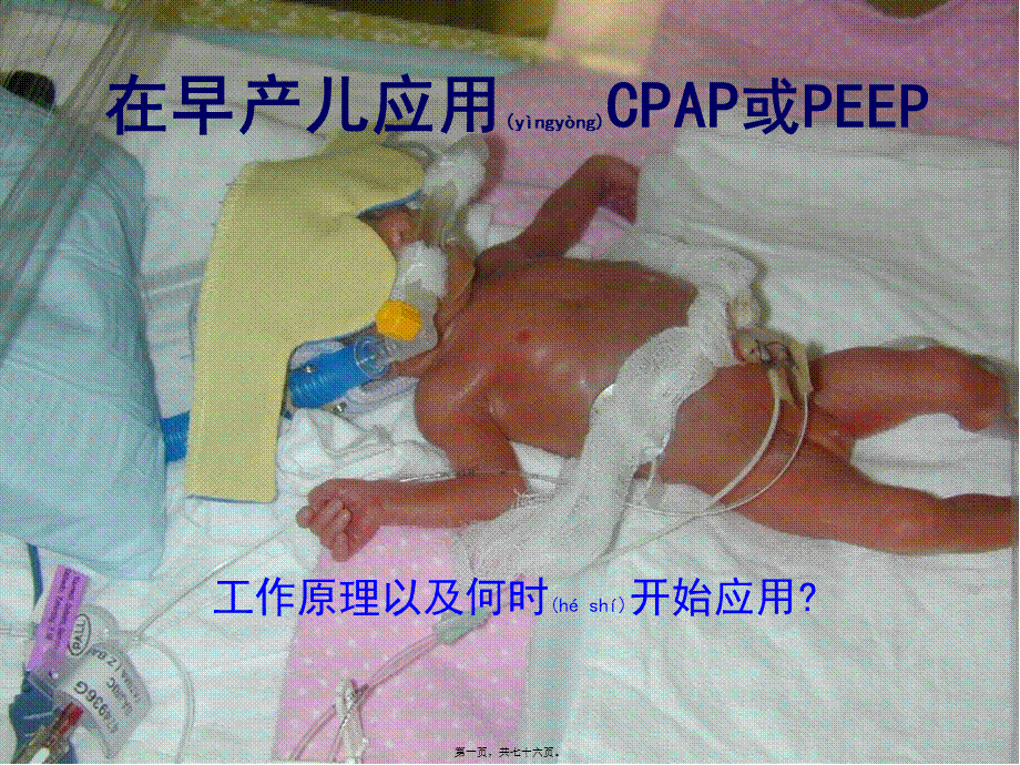 2022年医学专题—婴幼儿CPAP呼吸机.ppt_第1页