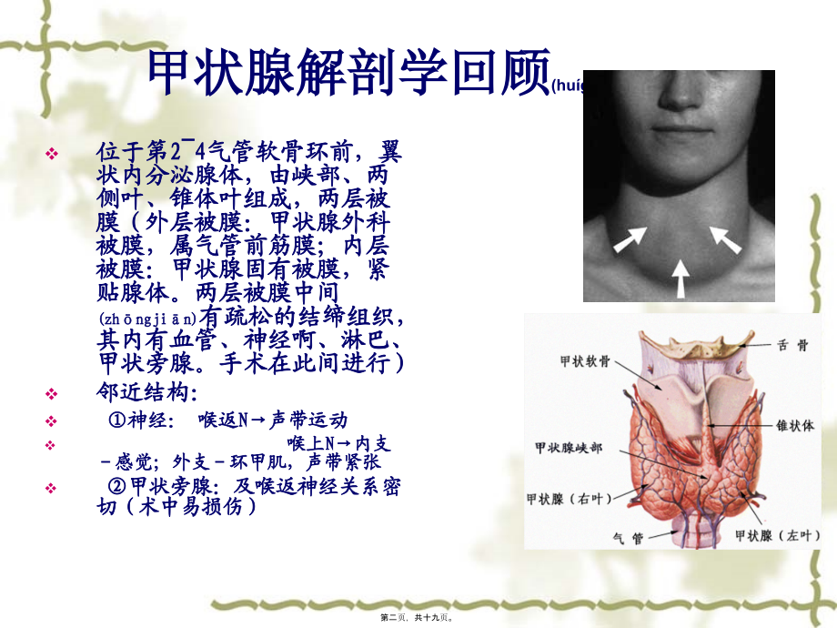 2022年医学专题—甲状腺亢进病人的.ppt_第2页