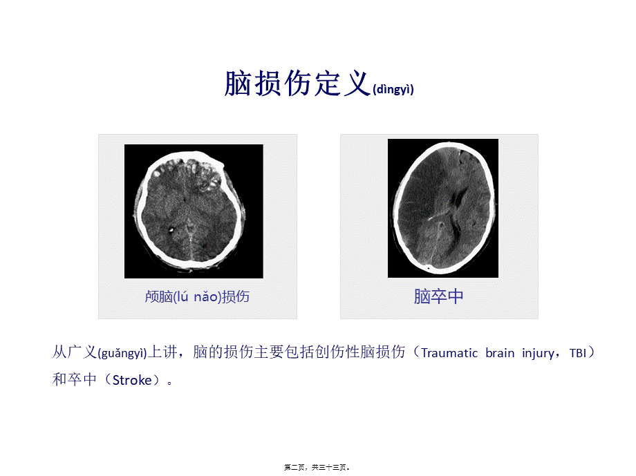 2022年医学专题—NGF与认知功能障碍(1).pptx_第2页