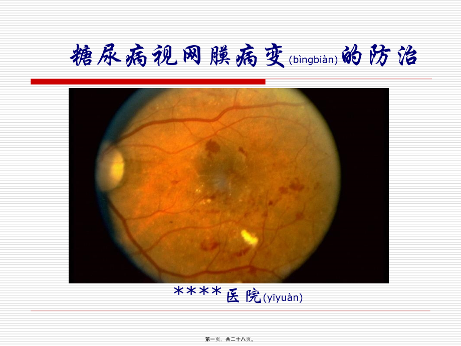 2022年医学专题—糖尿病视网膜病变宣教.ppt_第1页