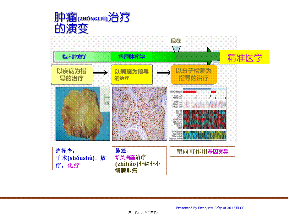 2022年医学专题—肺癌化疗进展(1).pptx_第3页