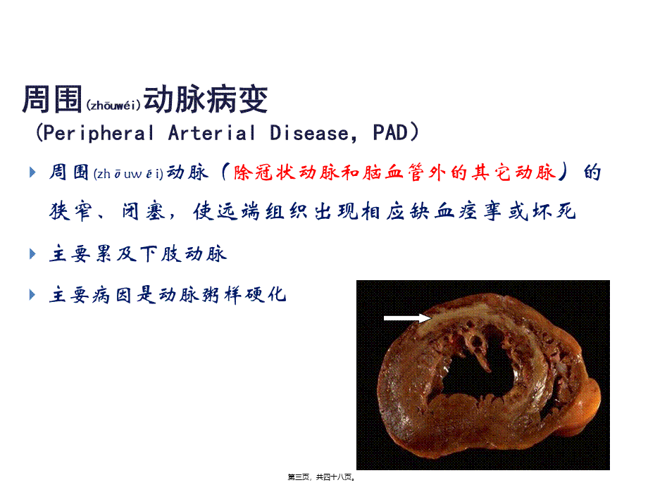 2022年医学专题—他汀对糖尿病患者的作用.pptx_第3页