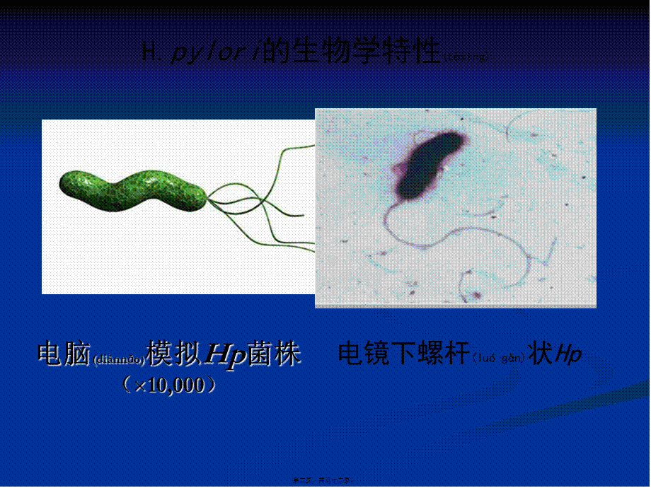 2022年医学专题—依赖于胃镜活检快速尿素酶试验RUT.ppt_第2页