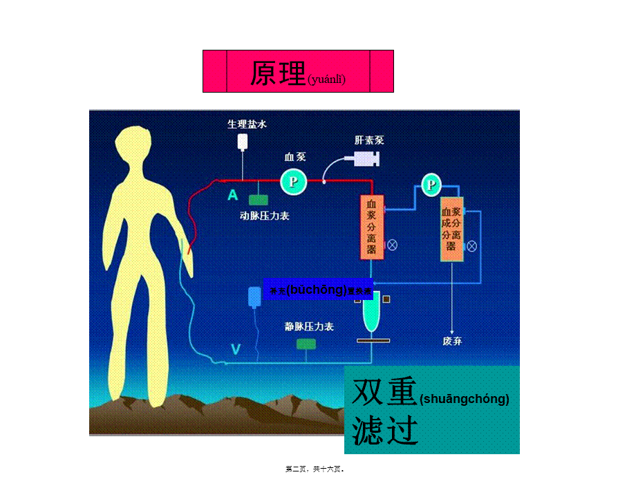 2022年医学专题—双重滤过血浆置换不良反应及处理(1).ppt_第2页