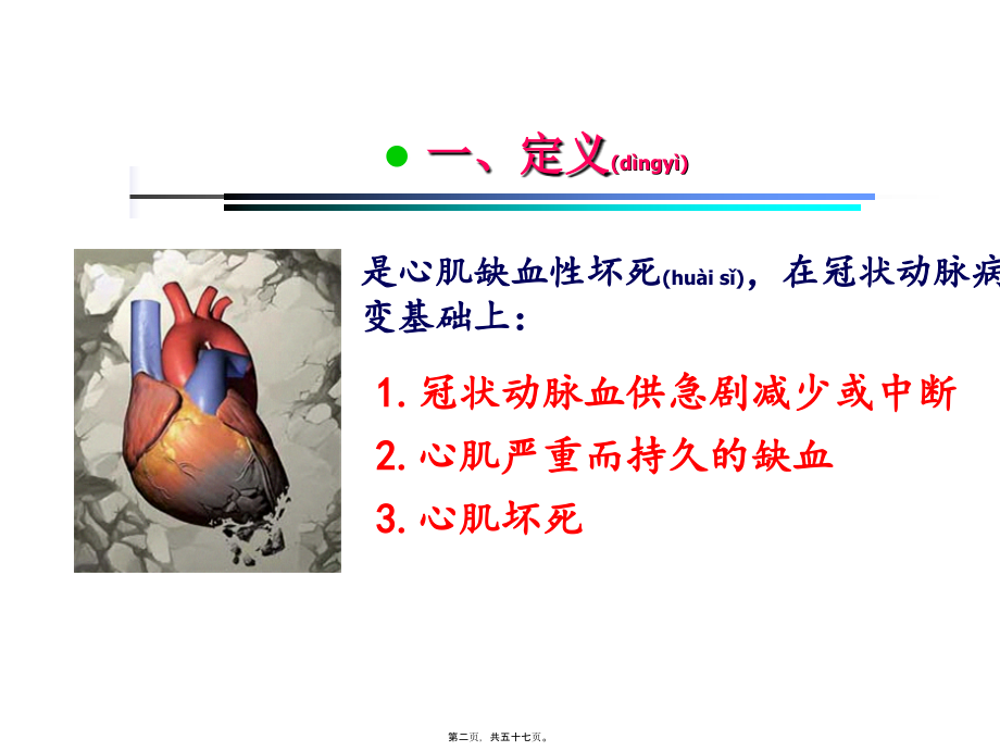 2022年医学专题—急性心肌梗死-新.ppt_第2页