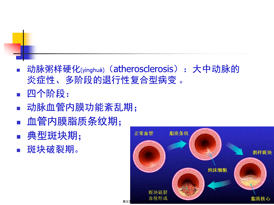 2022年医学专题—人卫第七版------营养与动脉粥样硬化性心脏病.ppt_第3页