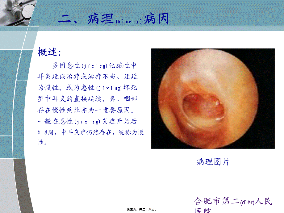 2022年医学专题—慢性化脓性中耳炎qq系列(1).ppt_第3页