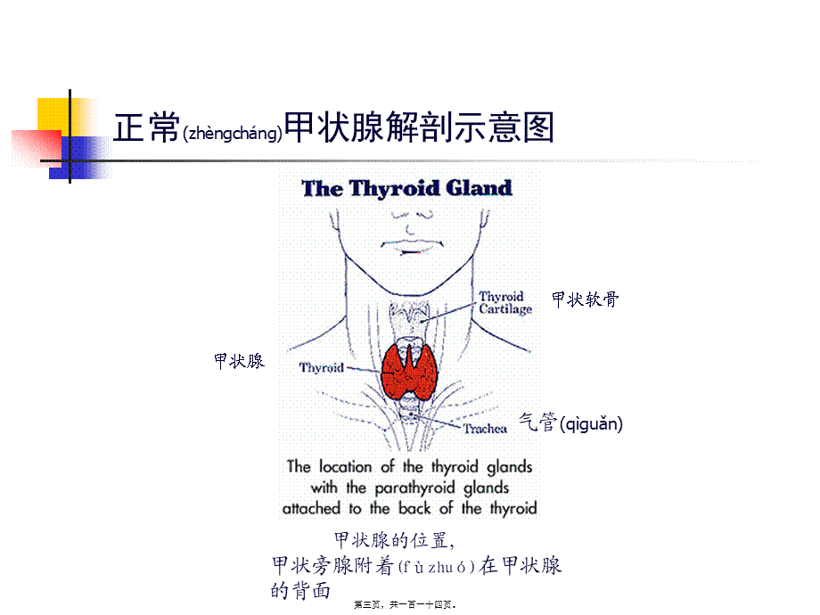 2022年医学专题—甲状腺功能亢进症PPT(1).ppt_第3页