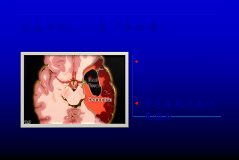 2022年医学专题—脑缺血—急性脑梗死的影像学表现.ppt_第3页