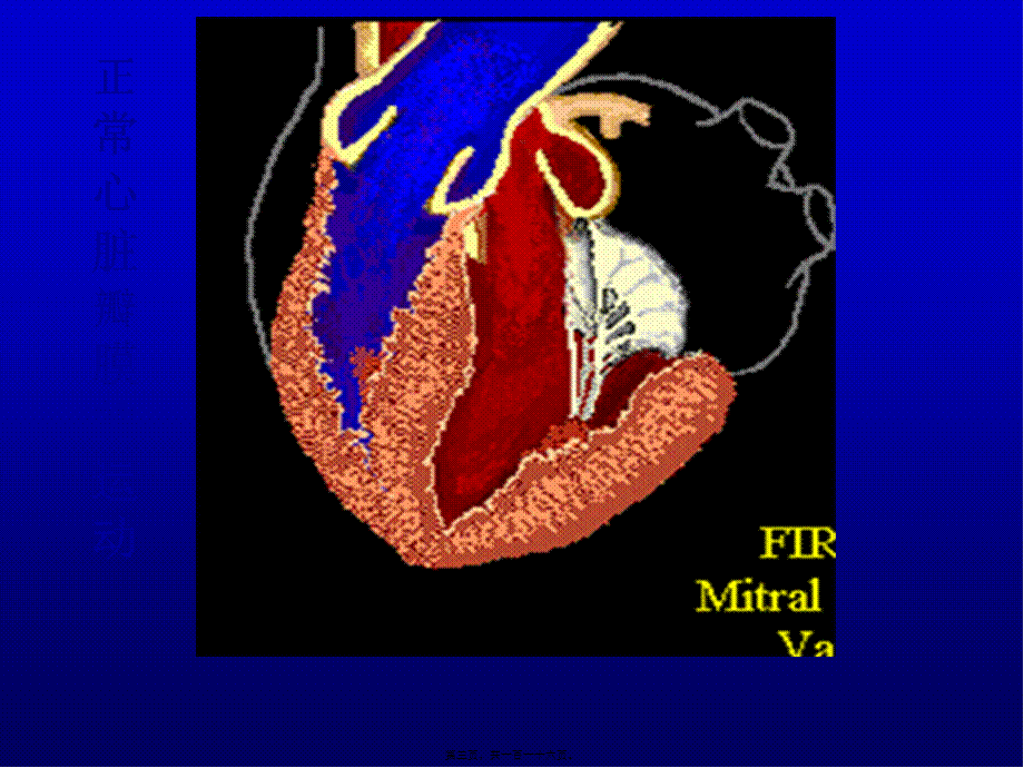 2022年医学专题—ValvularHeartDisease心脏瓣膜病-PPT文档(1).ppt_第3页