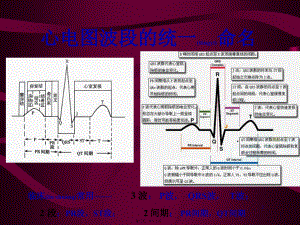 2022年医学专题—心电图-心电向量与心肌缺血.ppt