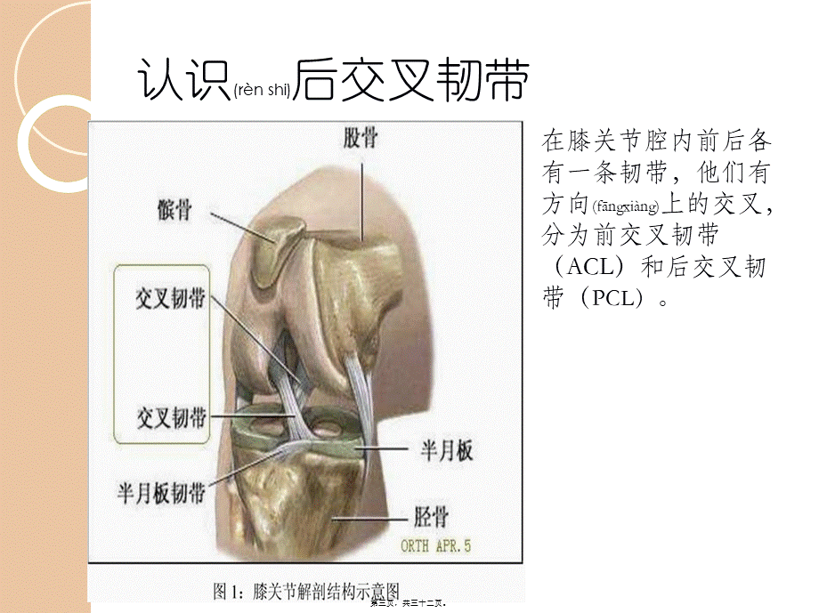 2022年医学专题—后叉韧带损伤的教学查房(1).ppt_第3页