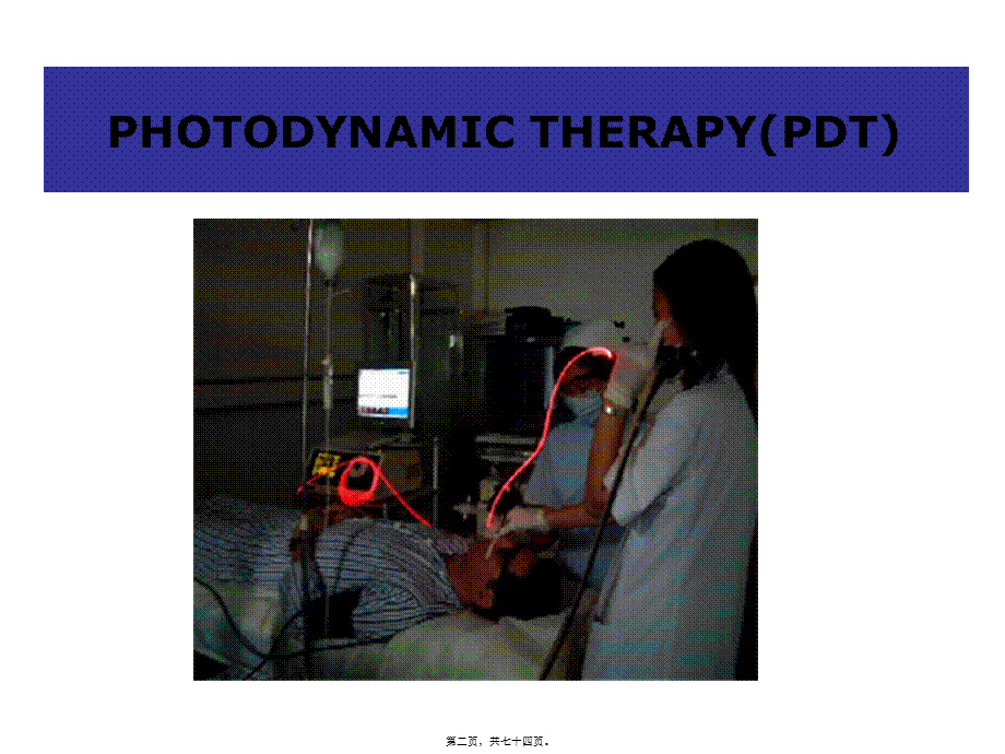2022年医学专题—光动力疗法根治早期癌有潜力-徐克成.ppt_第2页