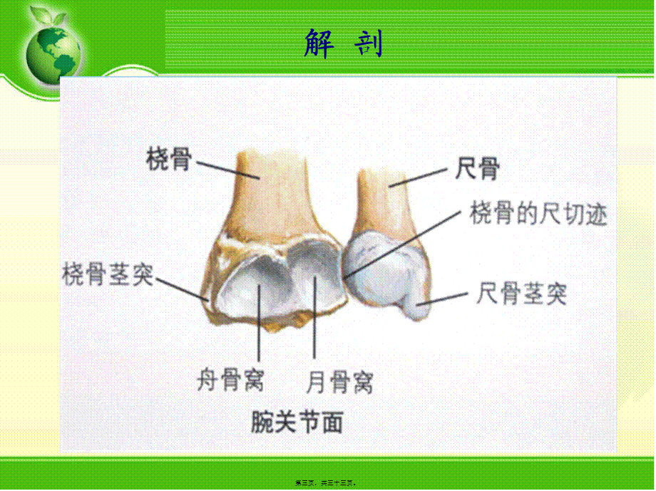 2022年医学专题—腕关节骨折(1).ppt_第3页