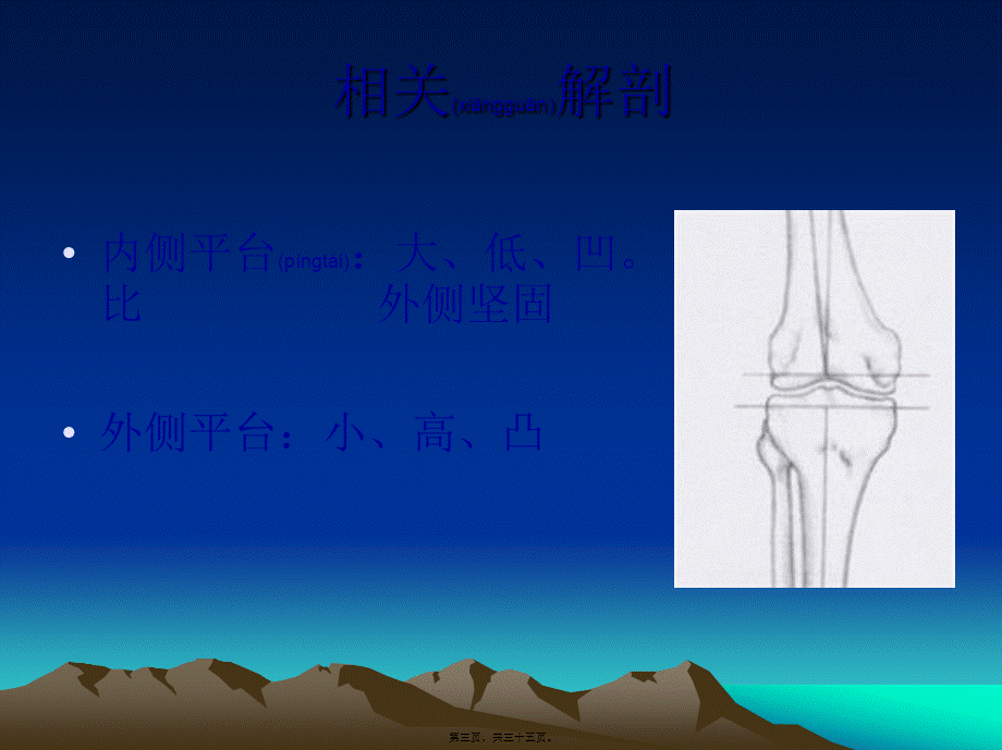 2022年医学专题—胫骨平台骨折(1).ppt_第3页
