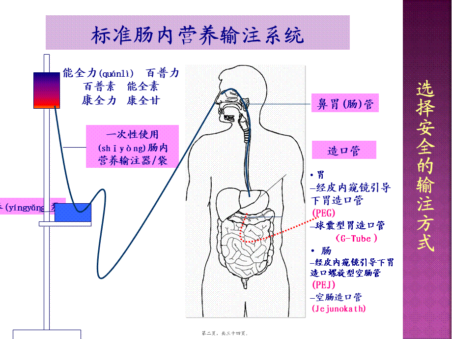 2022年医学专题—肠内营养并发症处理(1).pptx_第2页