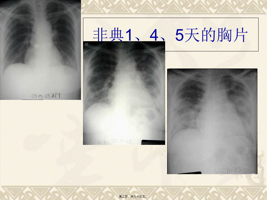 呼吸机的急诊应用.pptx_第2页