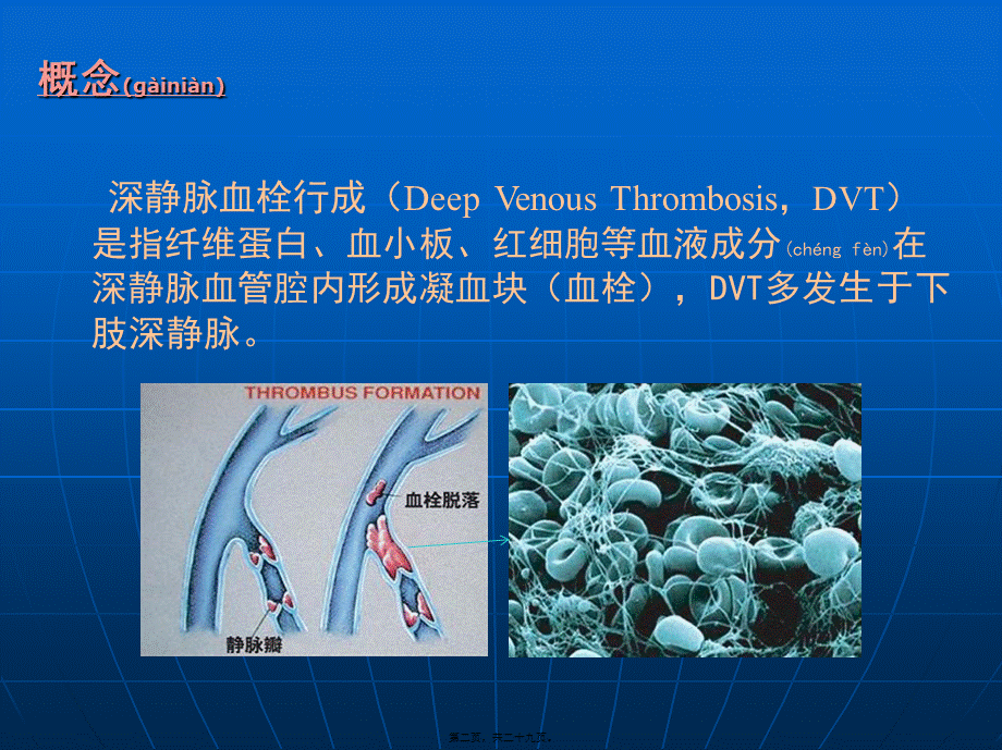 2022年医学专题—深静脉血栓诊治(1).ppt_第2页