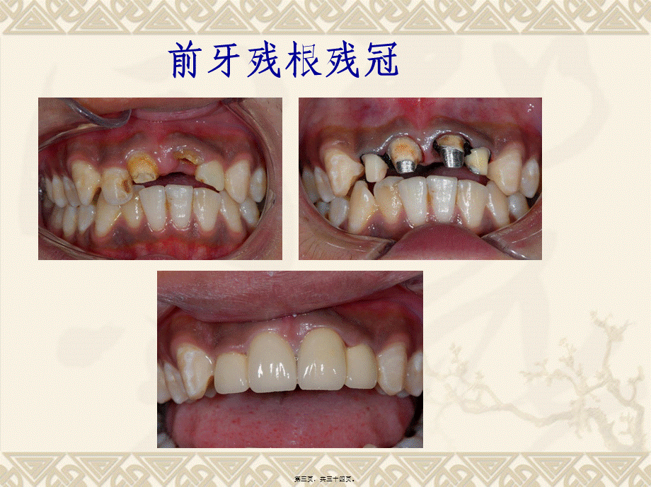 2022年医学专题—口腔修复医患沟通(1).ppt_第3页