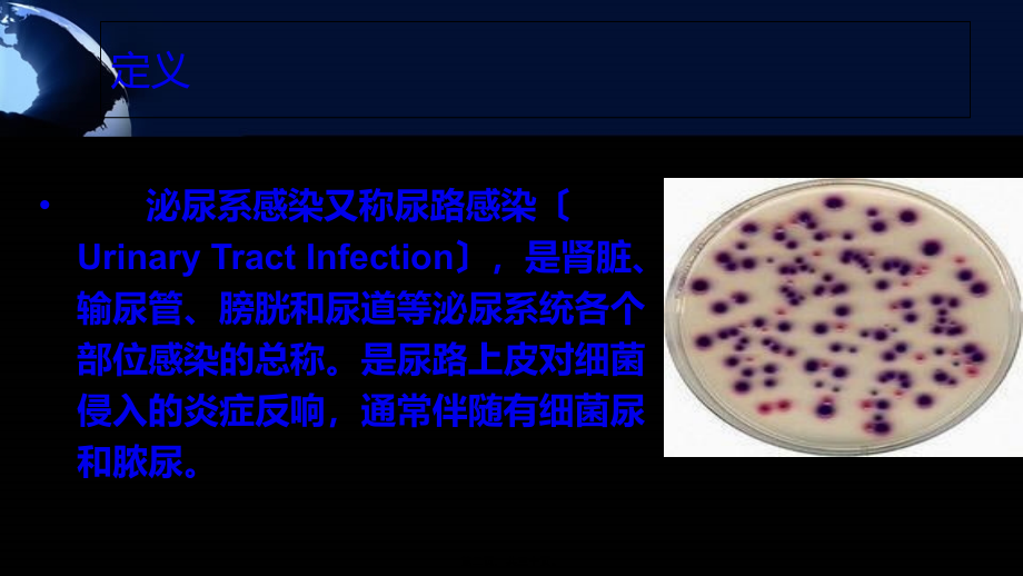 单纯性尿路感染.pptx_第2页