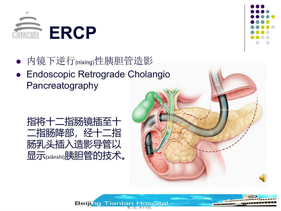 2022年医学专题—内镜下逆行性胰胆管造影.ppt_第2页