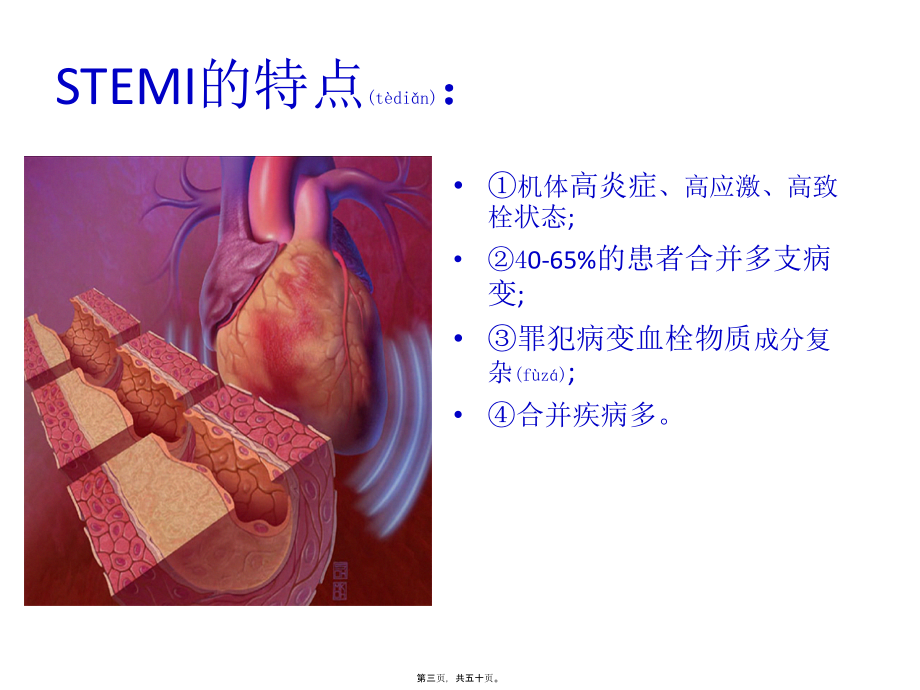 2022年医学专题—急诊PCI中同期还是分期处理非犯罪血管.pptx_第3页