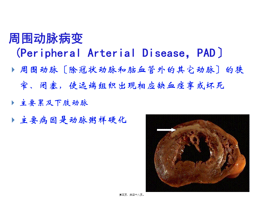 他汀对糖尿病患者的作用.ppt_第3页