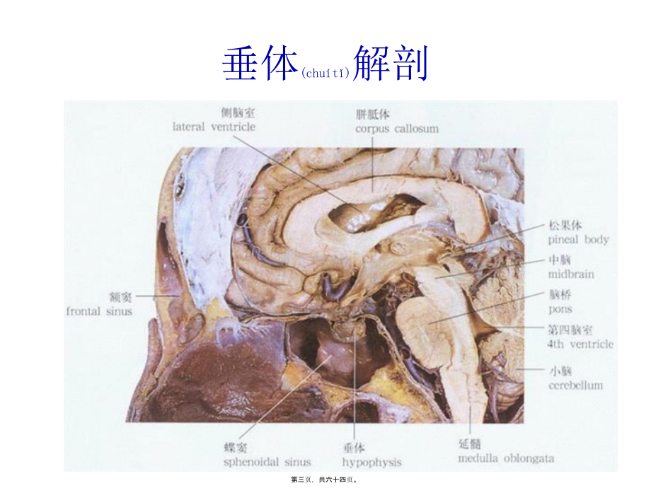 2022年医学专题—垂体瘤(1).pptx_第3页