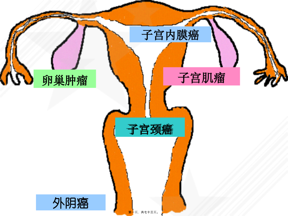 子宫颈癌-妇科知识.pptx_第1页