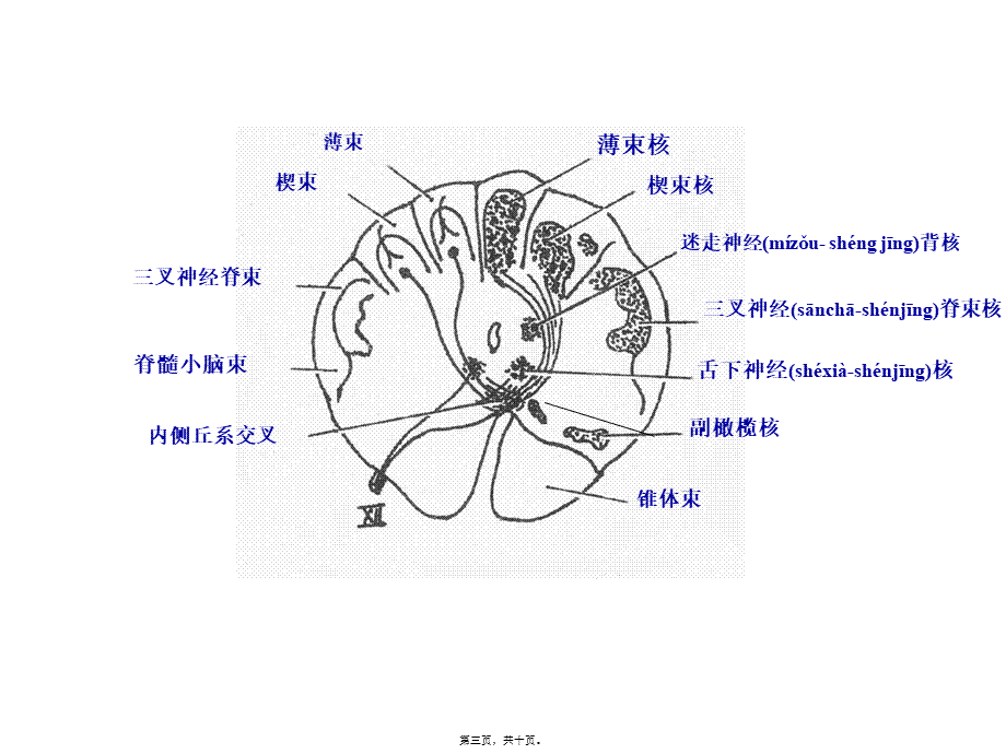 2022年医学专题—脑干断面图(作业)01幻灯片(1).ppt_第3页