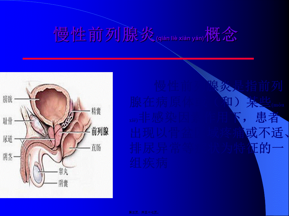 2022年医学专题—慢性前列腺炎(1).ppt_第3页