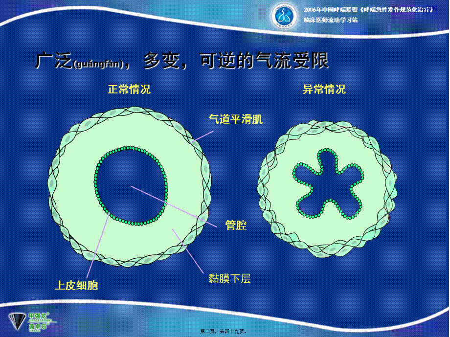 2022年医学专题—支气管扩张剂在支气管哮喘急性发作时的应用.ppt_第2页