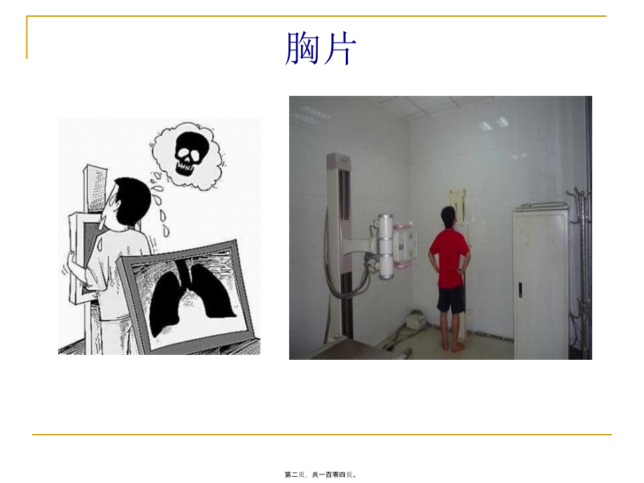 2022年医学专题—呼吸科X线、CT带教(正常、基本病变均包含).ppt_第2页