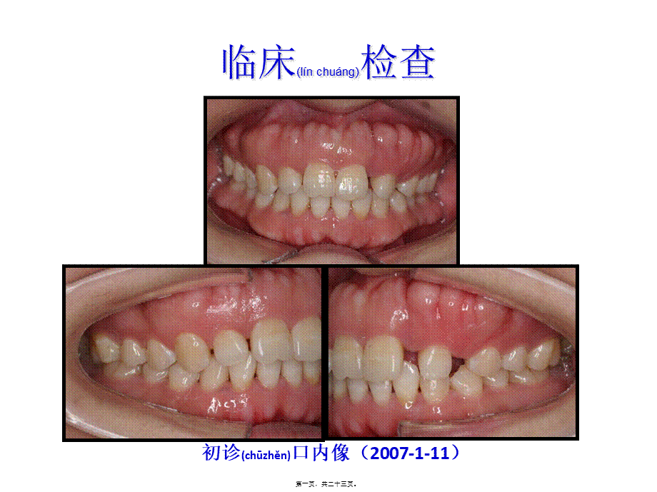 2022年医学专题—牙周手术(1).ppt_第1页