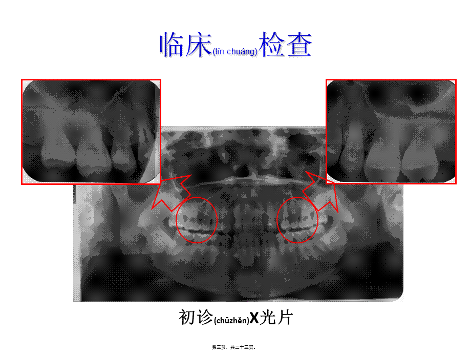 2022年医学专题—牙周手术(1).ppt_第3页