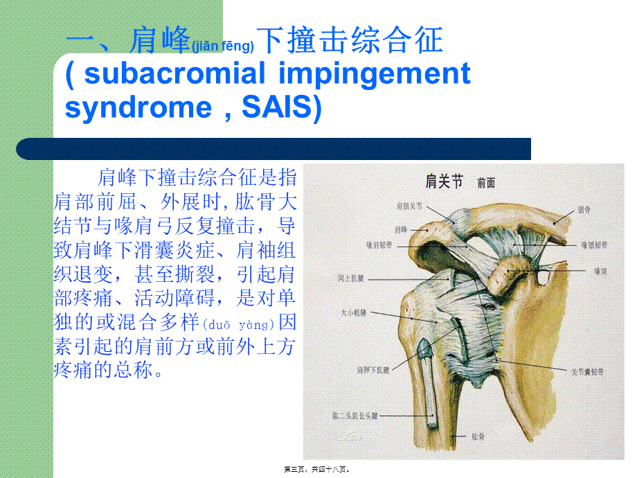 2022年医学专题—肩峰下撞击综合征(1).ppt_第3页