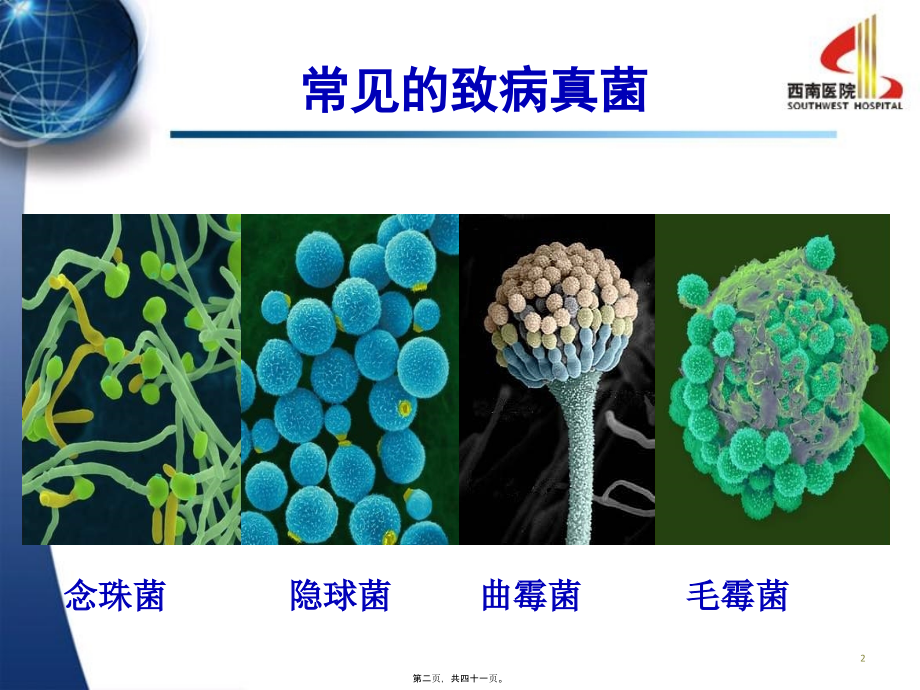 从实践看呼吸科肺部真菌感染(第三军医大学西南医院呼吸科-熊玮).pptx_第2页