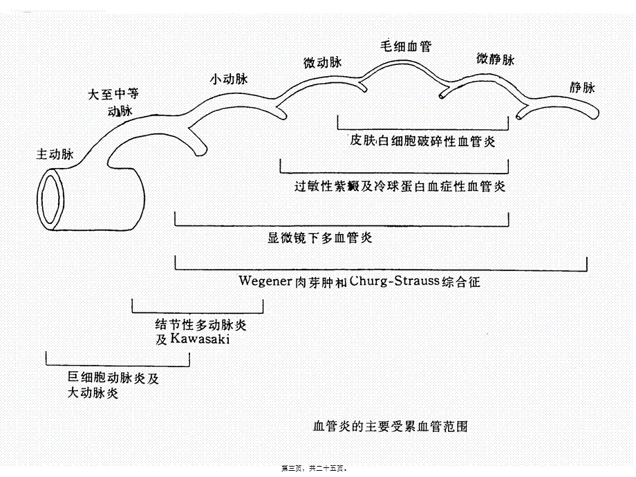 2022年医学专题—ANCA相关性血管炎的诊治进展(1).ppt_第3页