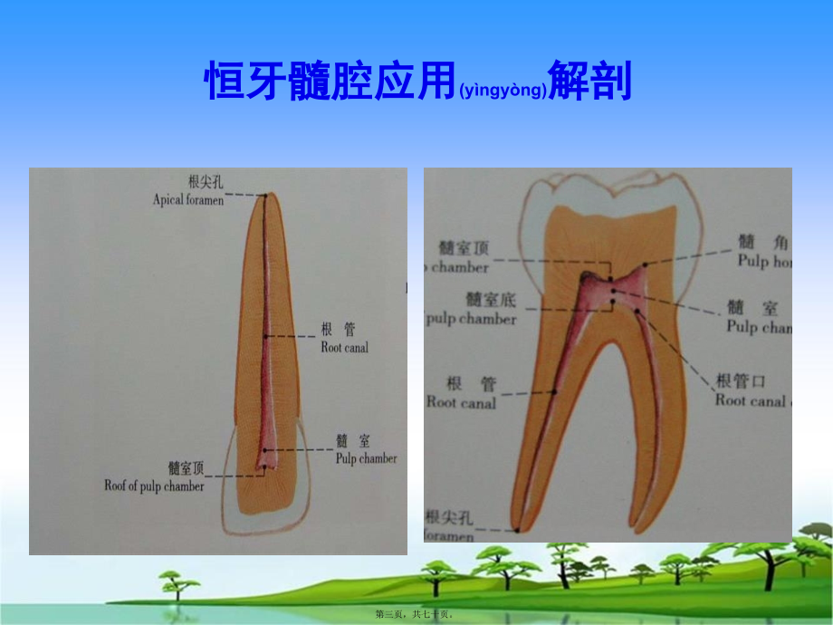 2022年医学专题—口腔开髓.ppt_第3页