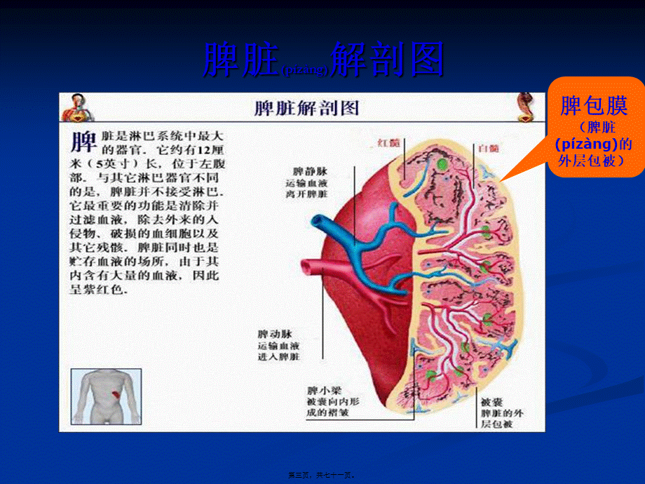 2022年医学专题—脾破裂-修(1).ppt_第3页