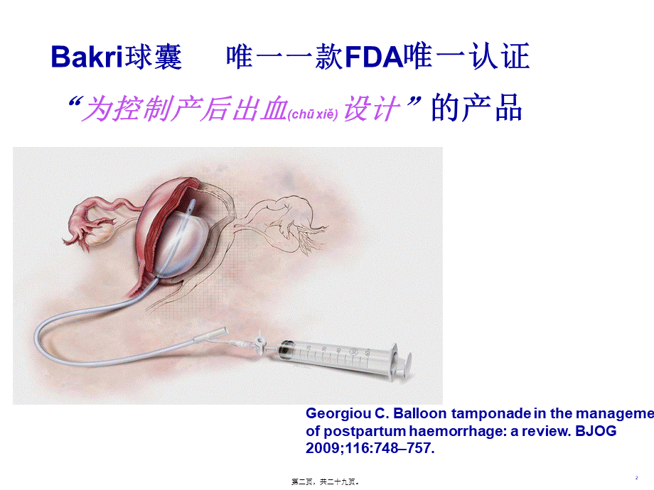 2022年医学专题—BAKRI子宫填塞球囊导管(1).ppt_第2页