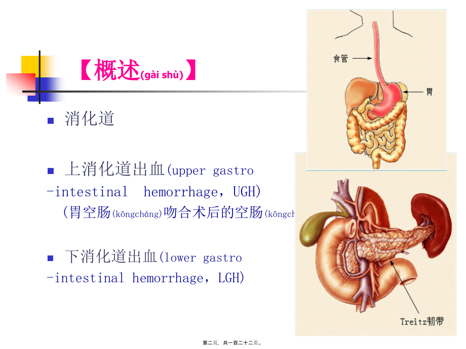 2022年医学专题—消化道出血进修班课程.ppt_第2页