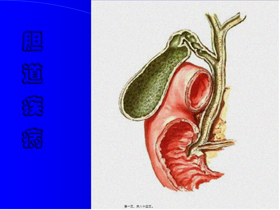 2022年医学专题—胆囊穿孔(1).ppt_第1页