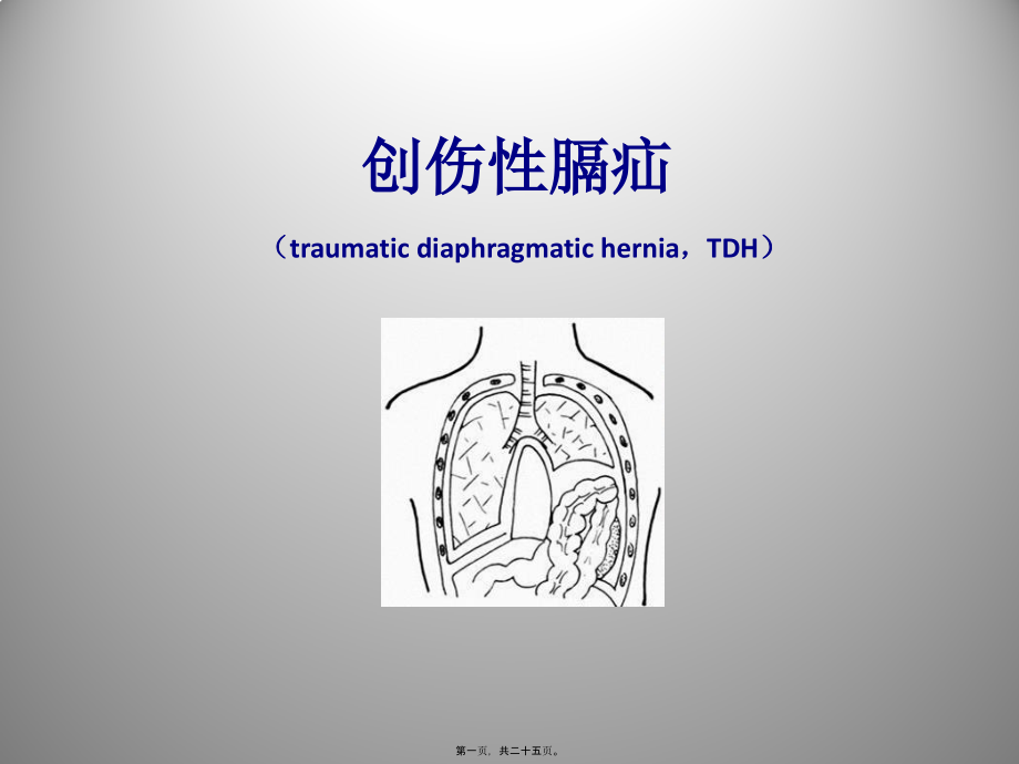 2022年医学专题—创伤性膈疝(1).pptx_第1页