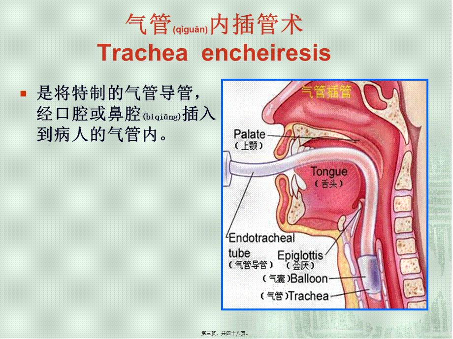 2022年医学专题—气管插管术(1).ppt_第3页