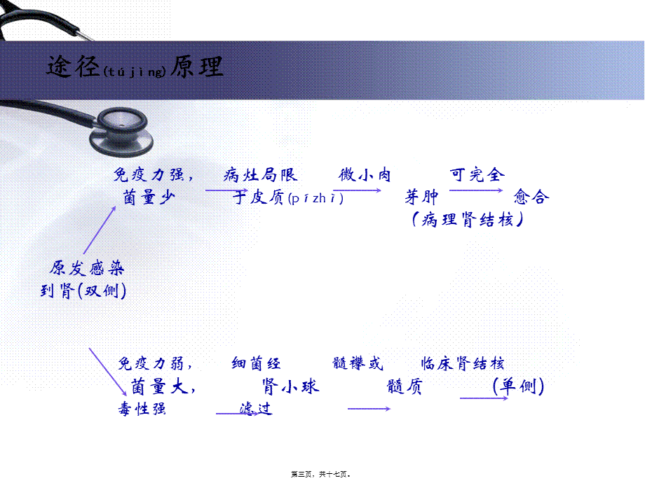 2022年医学专题—泌尿、男生殖系统结核(1).ppt_第3页